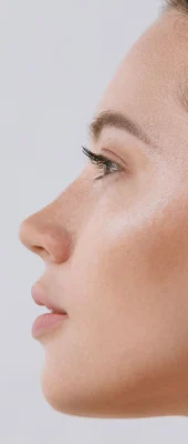 Rhinoplasty (4)