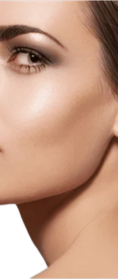 Rhinoplasty (5)